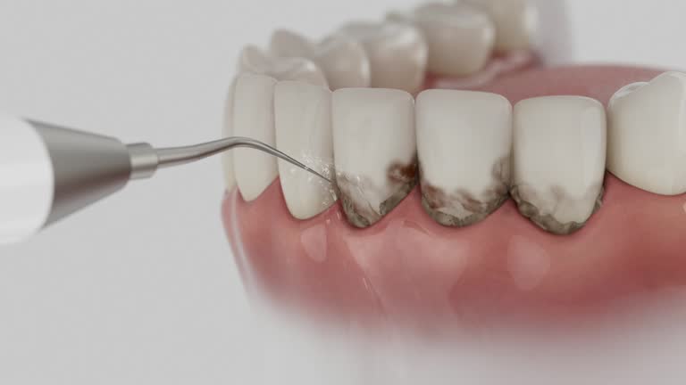 Reliable Dental Implants contractor in Keyser, WV by Smile Center Dentistry